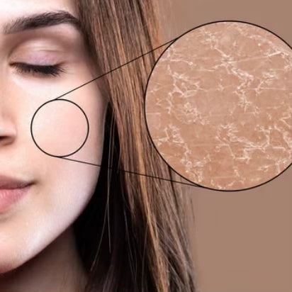Dry Skin